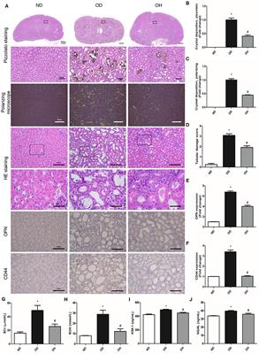 Oral Hydrogen-Rich Water Alleviates Oxalate-Induced Kidney Injury by Suppressing Oxidative Stress, Inflammation, and Fibrosis